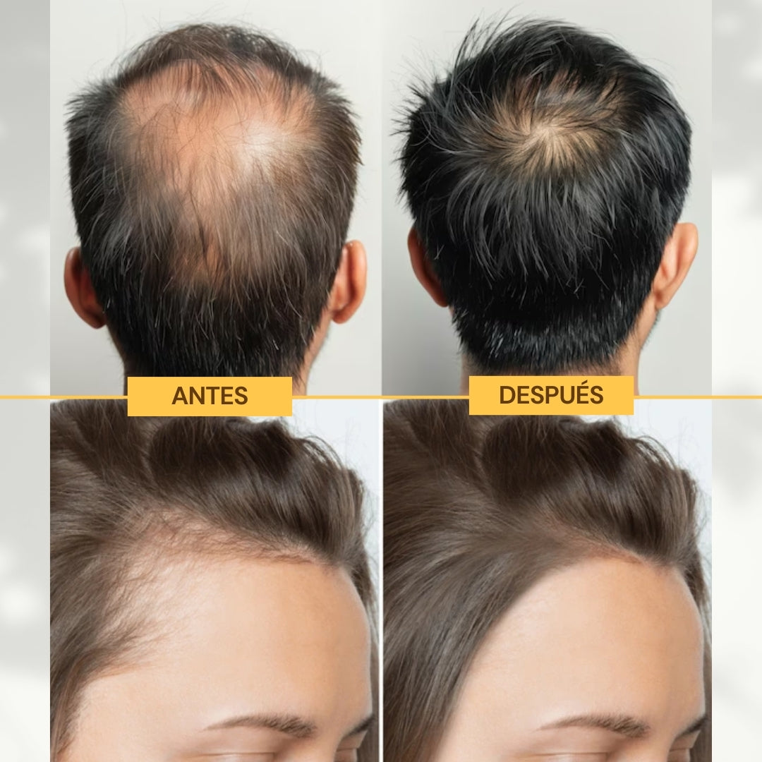 HAIRVIVE: Aceite para el Crecimiento Capilar