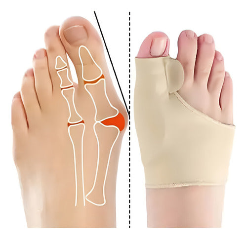 Corrector y Separador de Juanetes